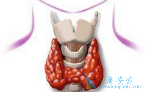 甲状腺肿瘤 甲状腺肿瘤
