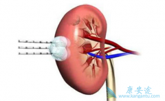 ��Щ֢״����������������֢״��