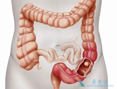 ߻����������ƽ�ֱ������ת����