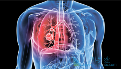 �ΰ�����֢״��������ʲô���֣�