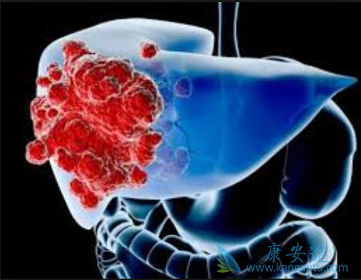 治疗肝癌 治疗肝癌