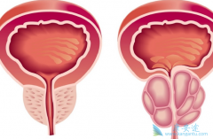 ����������ǰ���ٰ���������ʲô���ã�