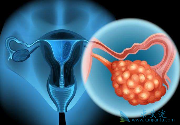 尼拉帕尼说明书 尼拉帕尼说明书