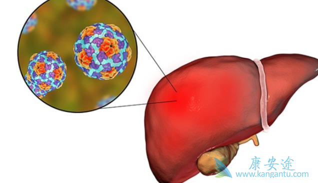 中药治疗丙肝 中药治疗丙肝