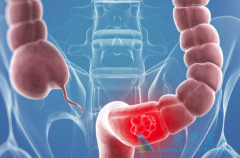 ��ֱ�������ߵ���Ҫ���Ʒ�������Щ