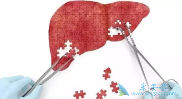 丙肝传播途径及预防 丙肝传播途径及预防