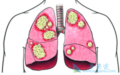 ���������������ڷΰ���ʲô���ƣ�