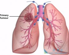 ��Сϸ���ΰ����Ʊ���ʹ��EGFR��������