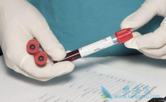丙肝的诊断方法 丙肝的诊断方法