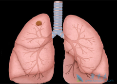 ���ڷΰ������Ʒ�������Щ��