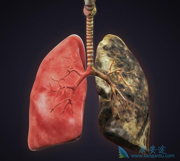 肺癌化疗 肺癌化疗