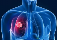 �ΰ�������ô���ƣ�