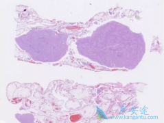 ��Ƥ�����κ���