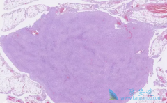 ��Ƥ��ԭ���֢״����Щ��