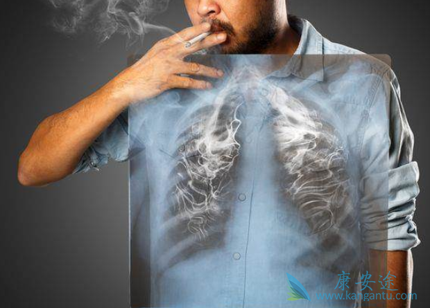 石棉肺癌与吸烟的关系 石棉肺癌与吸烟的关系