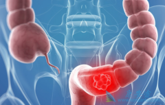 ��ֱ�������ƺ���ô������ЧԤ��������