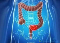 ��ֱ�����Ĳ�������Щ��