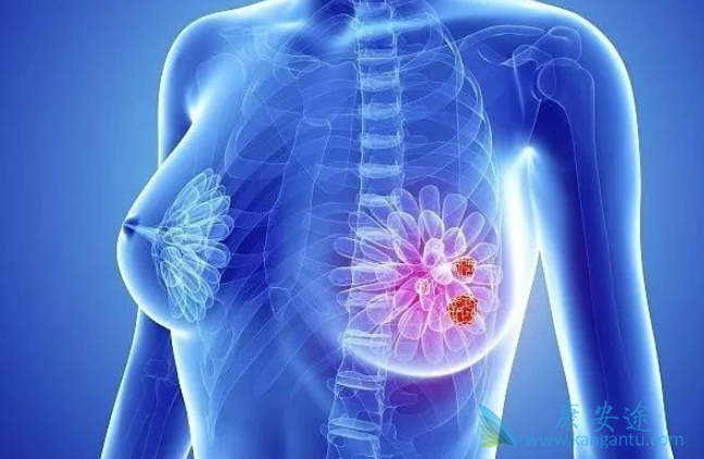 浸润性乳腺癌 浸润性乳腺癌