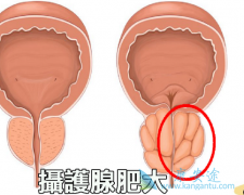 �㻤�ٰ�������֢״��ʲô