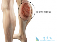 ����ά�����������ϼ���