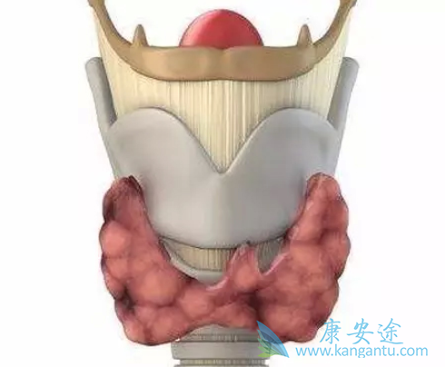 甲状腺肿瘤 甲状腺肿瘤