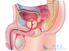 ��������Ҳ������ǰ���ٰ�֢״֮һ