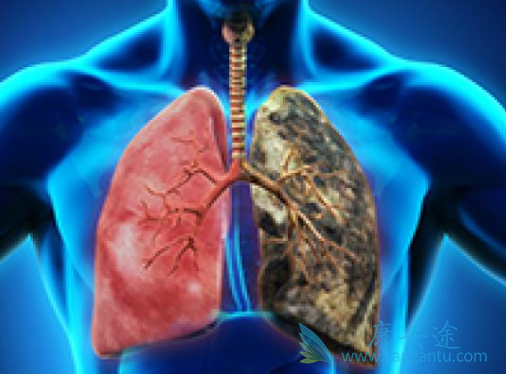 肺癌EGFR药物 肺癌EGFR药物