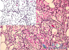 Inrebic���ƹ�����ά��Ч����ô����