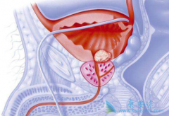 ʲô��ǰ���ٰ���ǰ���ٰ����Ʒ�������Щ��