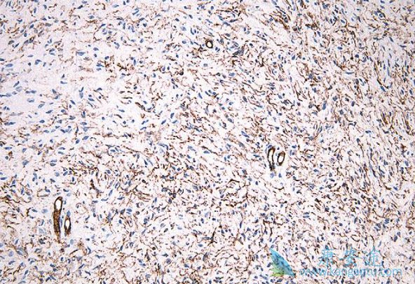 司美替尼 司美替尼