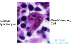 ������ܰ�����ǻ�����ܰ�����������ʲô��