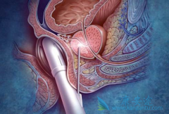 �������ѡ��ǰ���ٰ����Ʒ�����