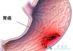 ��Щθ�������ܴ�PARP���Ƽ��л��棿