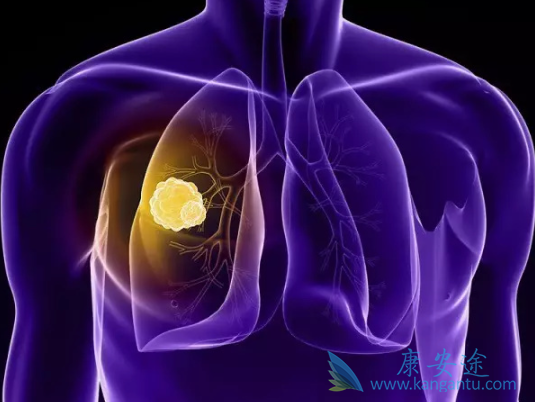 肺癌EGFR靶点 肺癌EGFR靶点