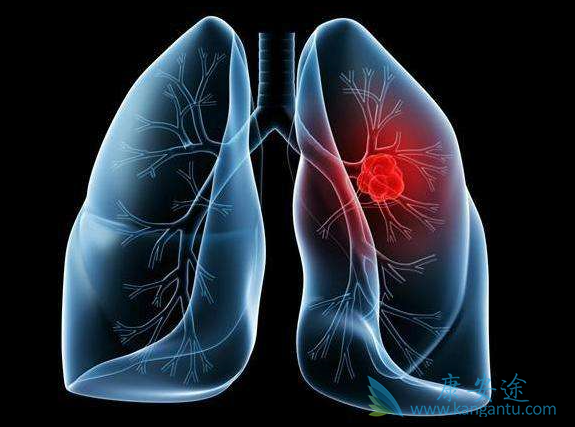 肺癌EGFR靶点 肺癌EGFR靶点