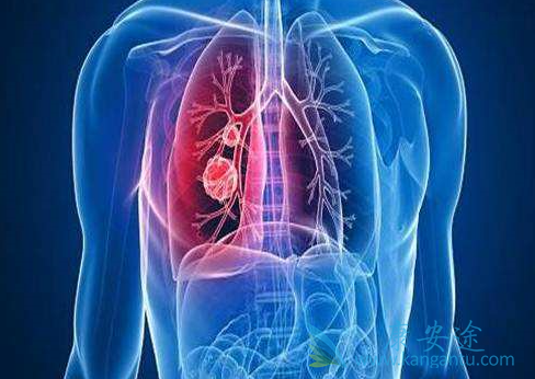 肺癌化疗方案 肺癌化疗方案