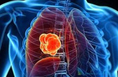 ALK���Ƽ���ɯ�������ת�ƻ�����Ч��