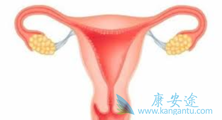 治疗卵巢癌 治疗卵巢癌