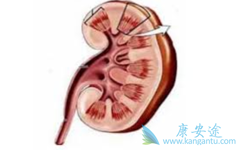 晚期肾癌 晚期肾癌