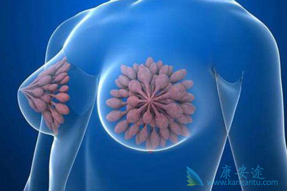 晚期乳腺癌 晚期乳腺癌