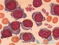 ���ƶ෢�Թ������ķ���������Щ��