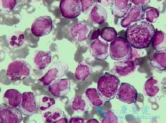 �������԰�Ѫ��֢״������Щ��