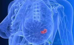 ������������HER2�������ٰ�����ҩ������������Ӧ