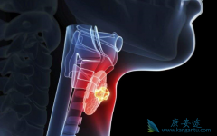 �����������Ƽ�״�ٰ�Ч����ô����