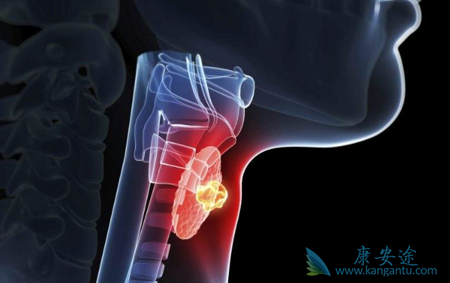 甲状腺癌 甲状腺癌