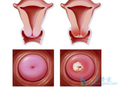 �����������ܻ��ã���ʲô֢״��