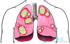 ���������ڷΰ�����������Ч����Σ�