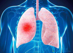 �ΰ���ʲô֢״���ΰ����˳�ʲô�ã�