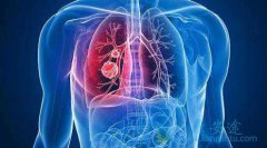 �ΰ�����е��Ǹ���ʲô����⣿