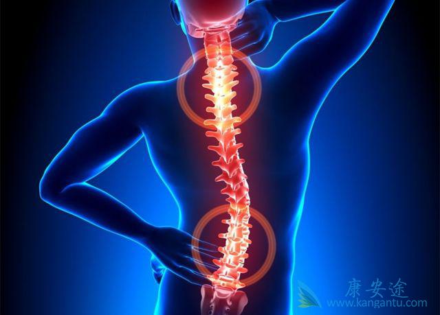 强直性脊柱炎 强直性脊柱炎